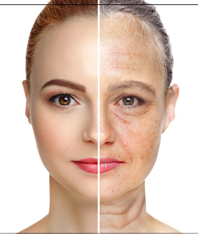 Vampire Facial Treatment