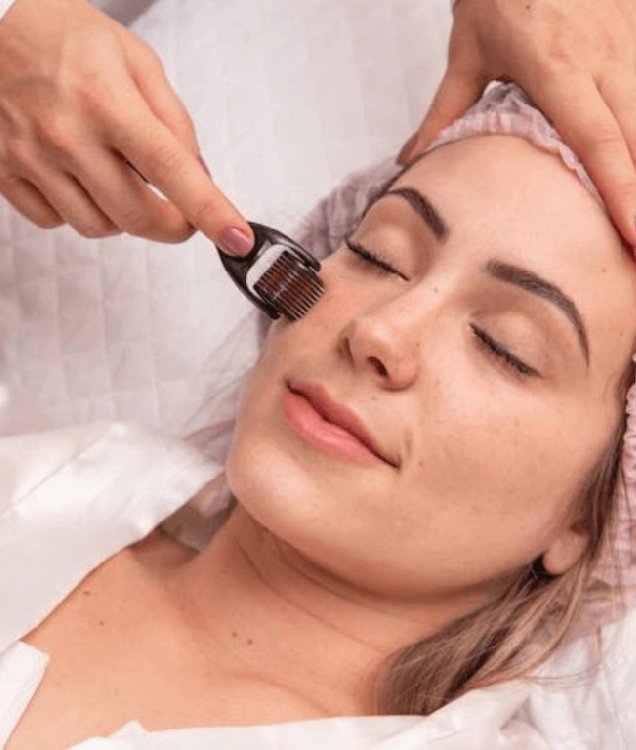 Derma Pen & Derma Rollers Treatment