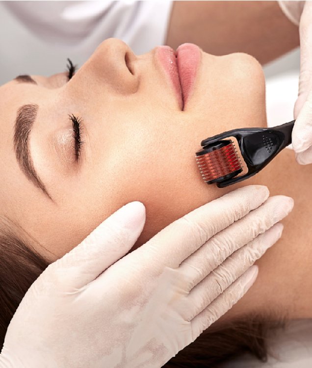Derma Roller Hair Treatment