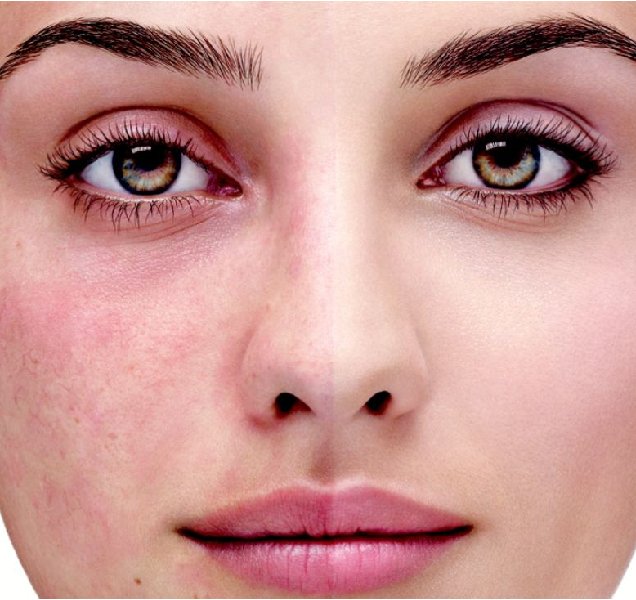 How Detan Treatment Works