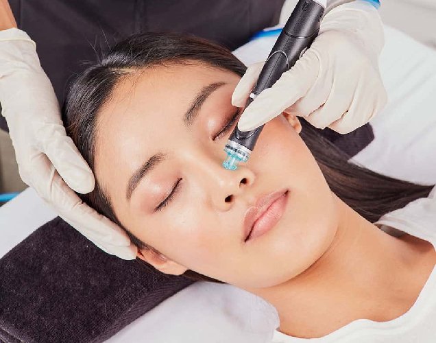 How Hydrafacial Works