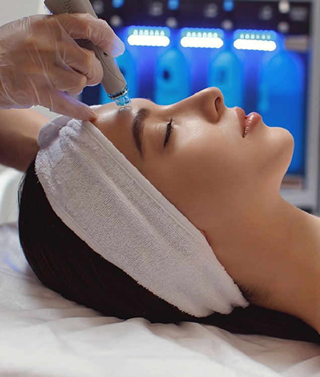 Hydra-peel Treatment