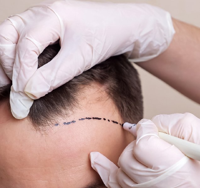 How Hair Regrowth Works