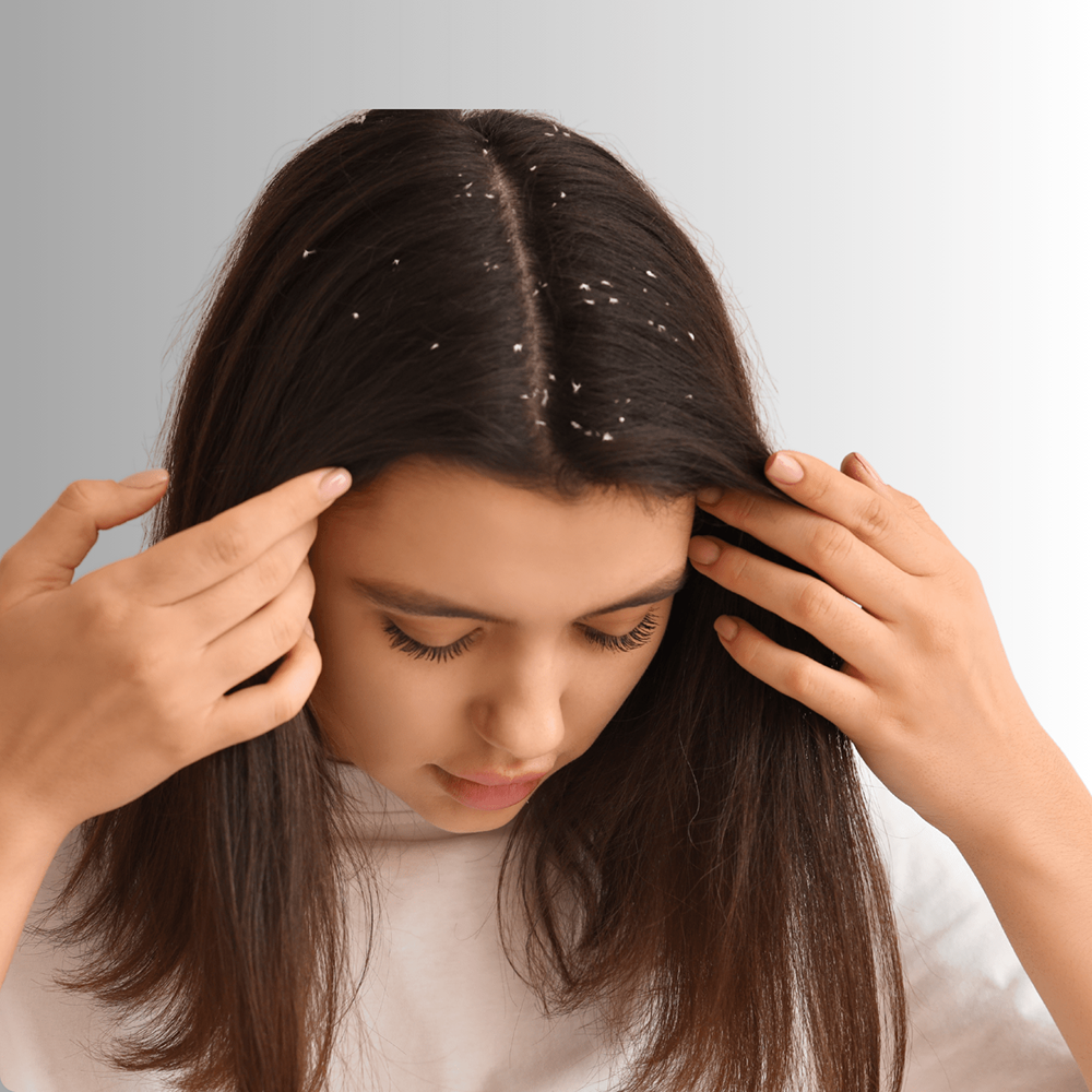 Dandruff-Treatment