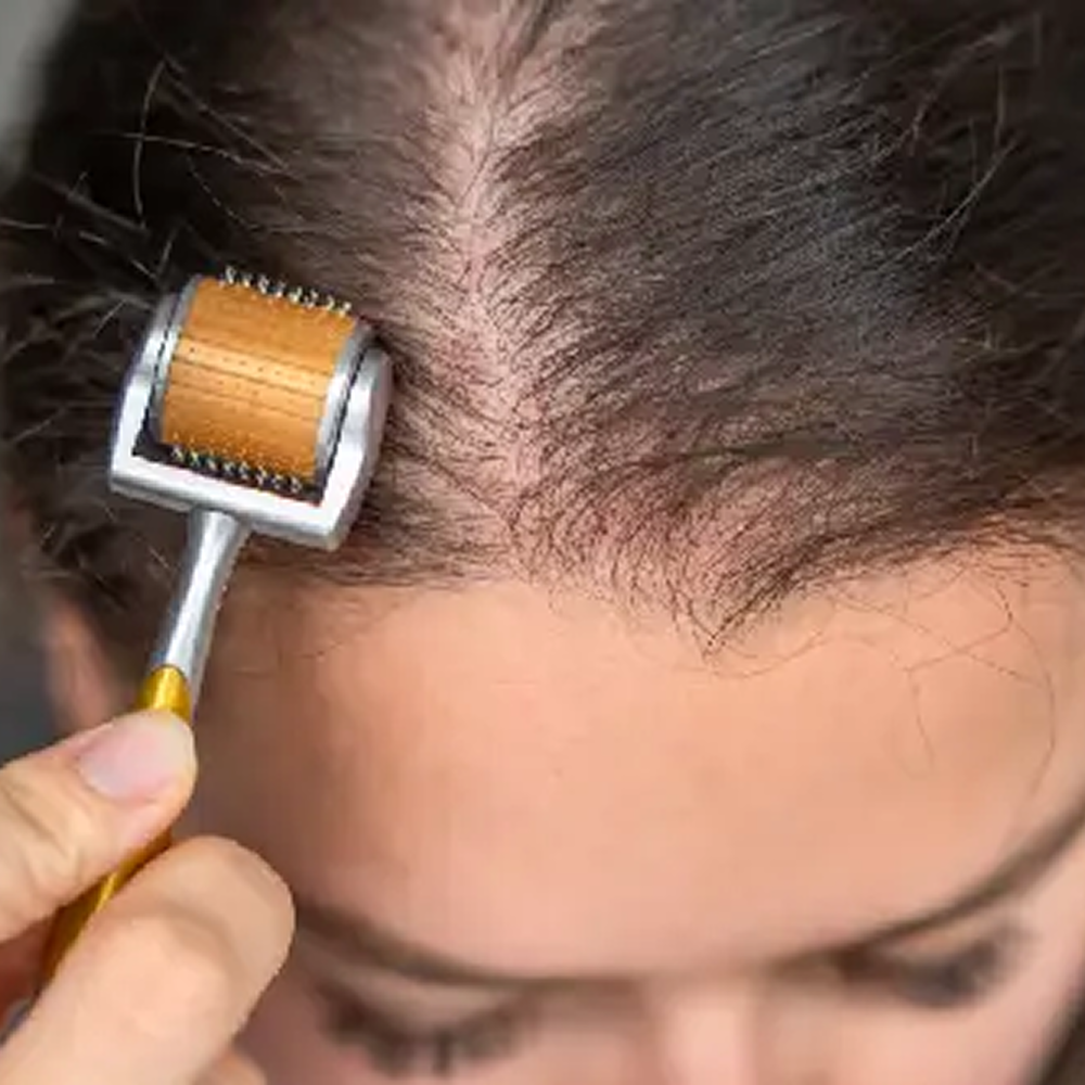 Derma-Roller-hair