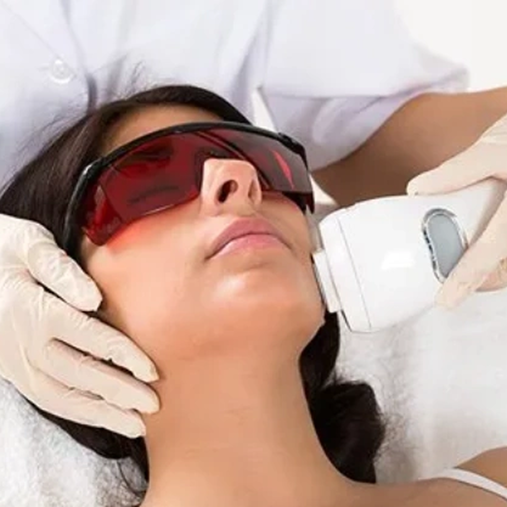 Laser-Hair-Reduction