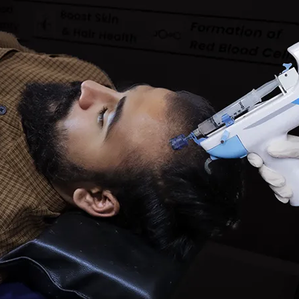 Mesogun-Mesotherapy-Precision-nutrient