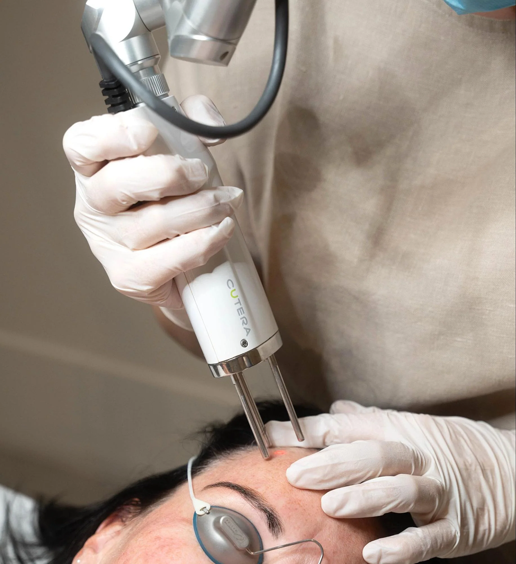 How Laser-Toning Procedure Works