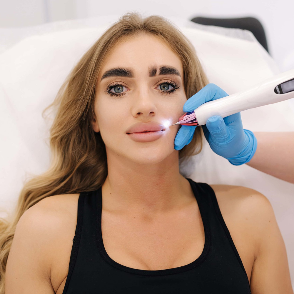 Plasma-Pen-Laser-Treatment