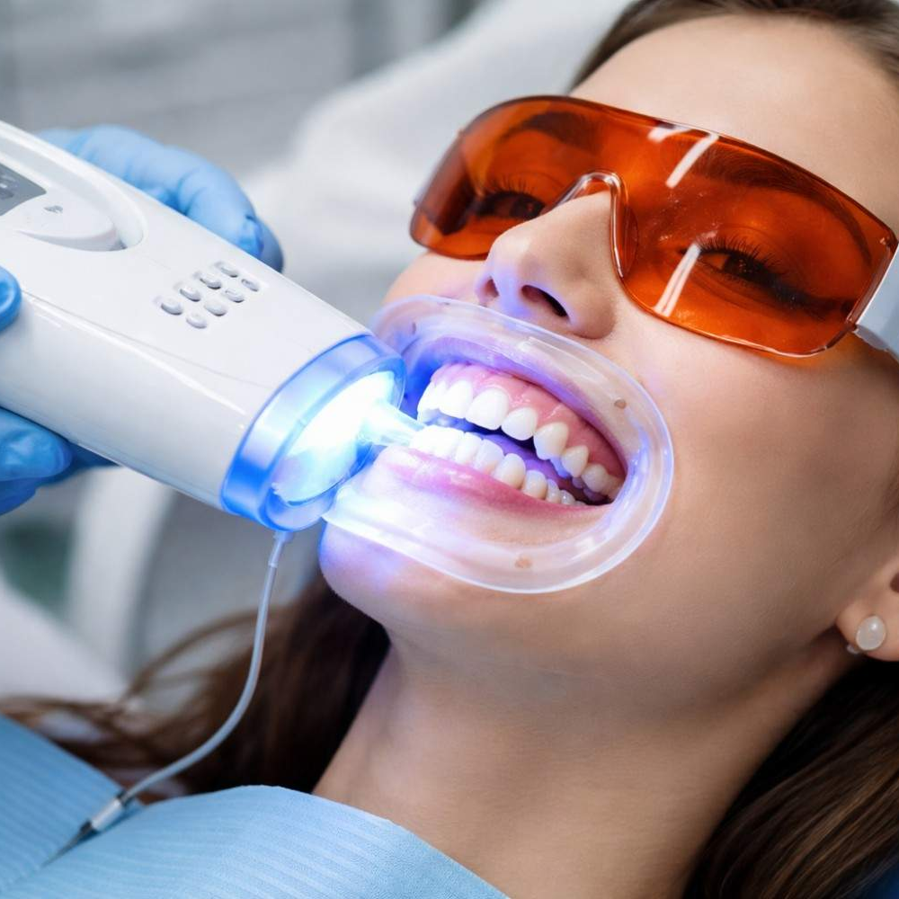 Teeth-Whitening